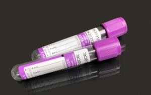 Пробирка вакуумная APEXLAB ЭДТА-К3, с двойным отрывным кодом, фиолетовая пробка, 6мл (13х100) (пластик) (100 шт.)